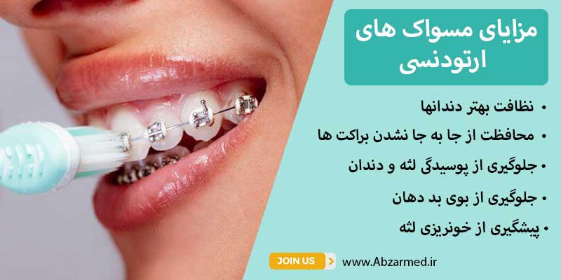 مزایای مسواک ارتودنسی بین دندانی از جمله جلوگیری از تکان خوردن پلاکت ها ، نظافت بهتر دندانها و.... می باشد.