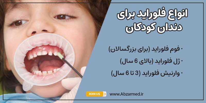 انواع فلوراید برای دندان کودکان عبارت است از وارنیش فلوراید و ژل فلوراید.